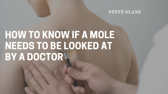Steve Glanz Mole Checked